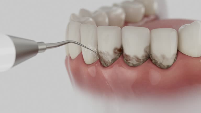 Trusted Emergency Dentist service in Sturgeon, MO - Dentist Open Now